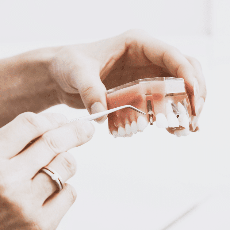 dental implant tooth loss carmel indiana