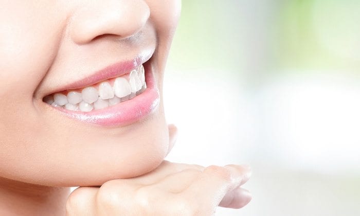 Take-home teeth whitening allows you to get a beautifully white smile on your schedule.